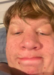 rencontre avec Ervin