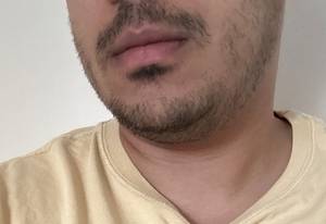 Dale rencontre avec Dale
