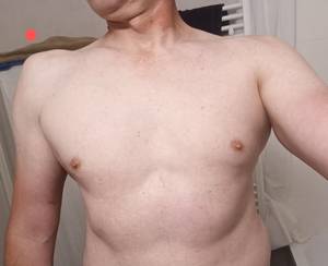 Todd rencontre avec Todd