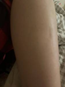 Hope rencontre avec Hope