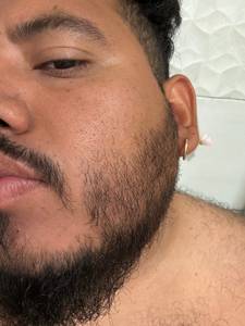 Acevedodonald73