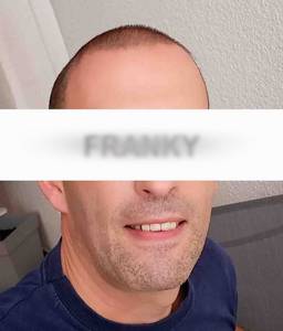 Doug rencontre avec Doug